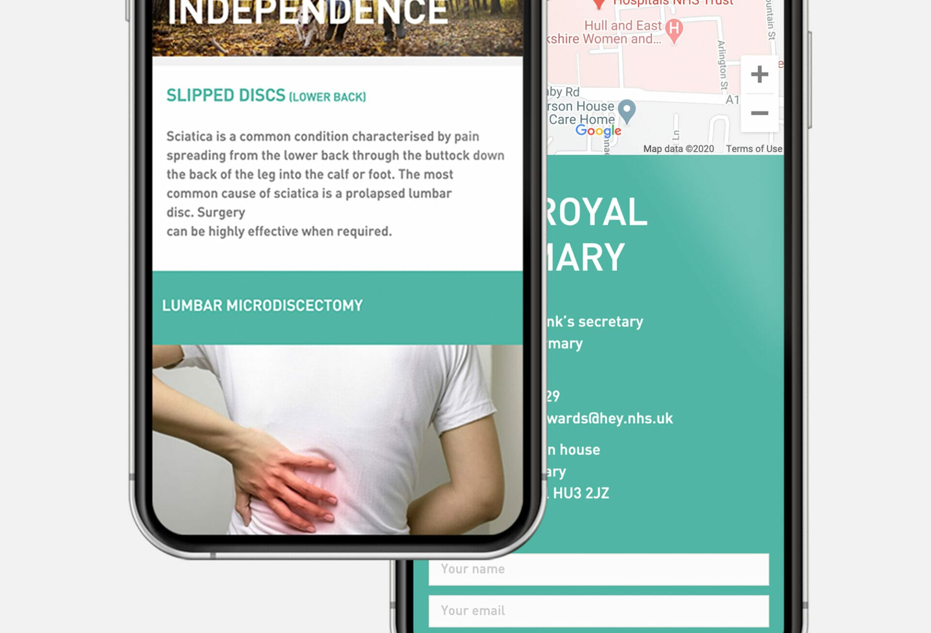 George Spink website on mobile showing image for lumbar microdiscectomy
